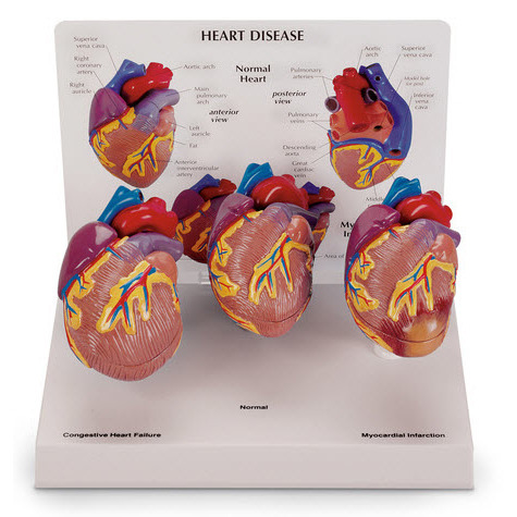 Mini Heart Set Models, 3-Piece