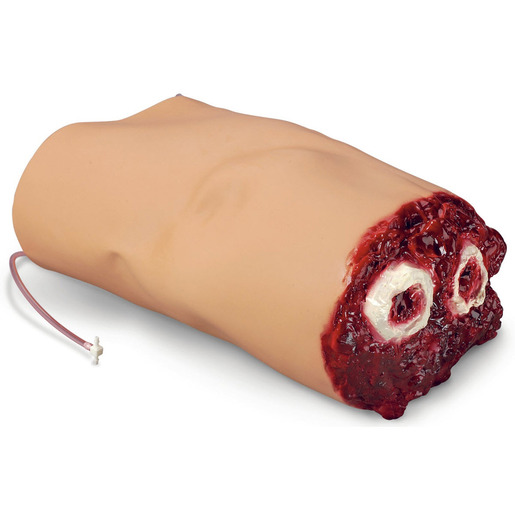 SMART STAT Amputated Bleeding Arm Simulator