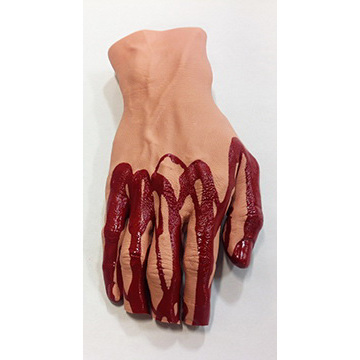 Non-bleeding Moulage, Hand with Severed Fingers