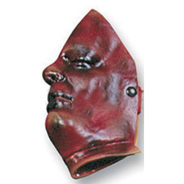 Burns Non-Bleeding Moulage