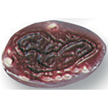 Burns Non-Bleeding Moulage